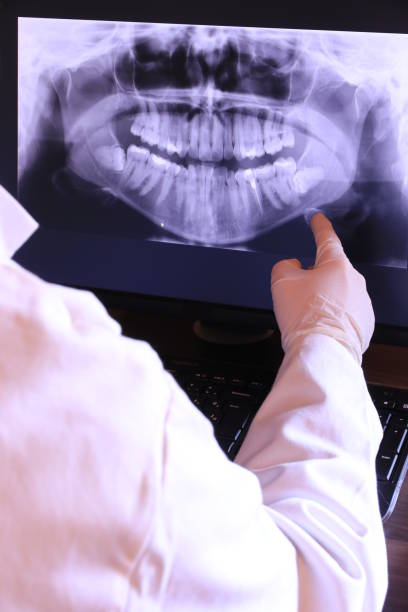Best Emergency Treatment for Dental Infections or Abscesses in Central Islip, NY